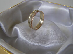 NŐI ARANY KARIKAGYŰRŰ , bicolor