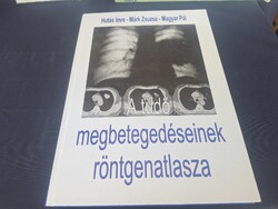 A tüdő megbetegedéseinek röntgenatlasza. 950.-Ft